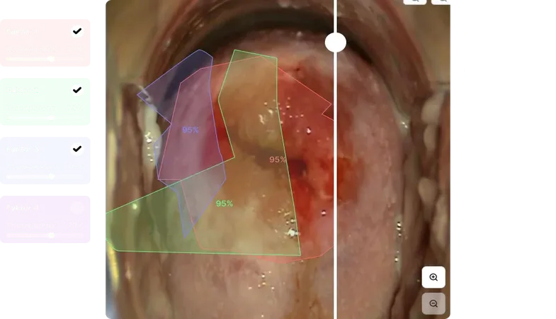 Procolpo-Oberfläche